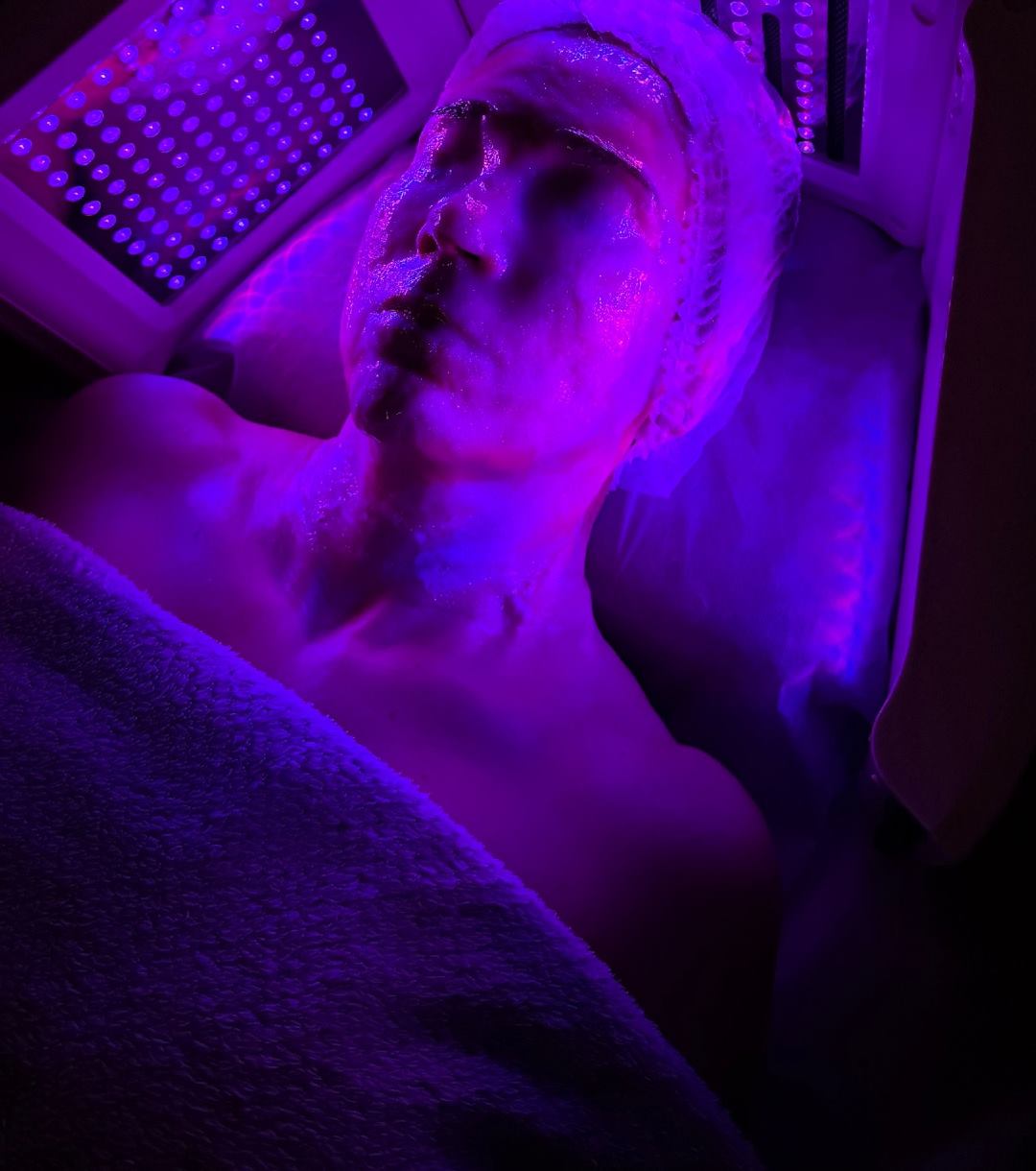 Rostro bajo luz LED violeta durante un facial